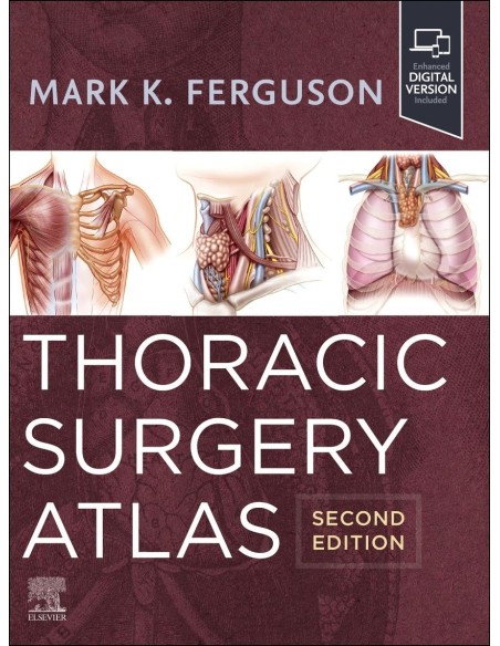 Thoracic surgery atlas