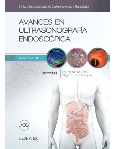 AVANCES EN ULTRASONOGRAFIA ENDOSCOPICA