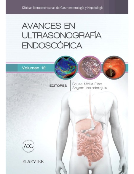 AVANCES EN ULTRASONOGRAFIA ENDOSCOPICA
