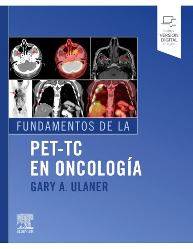 Fundamentos de la PET TC en oncologia