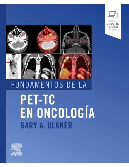 Fundamentos de la PET TC en oncologia