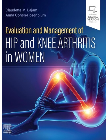 Evaluation and Management of Hip and Knee Arthritis in Women