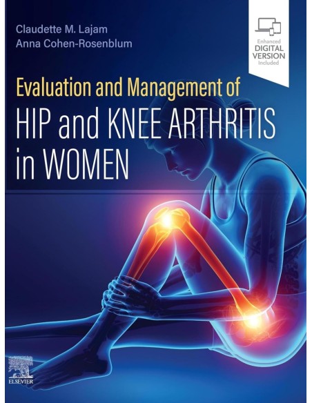 Evaluation and Management of Hip and Knee Arthritis in Women