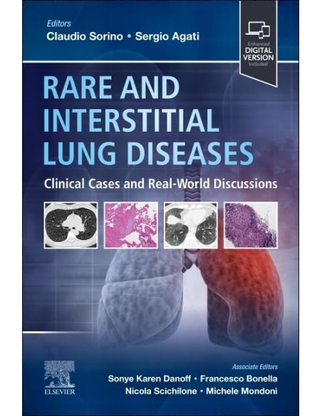 Rare and interstitial lung diseases
