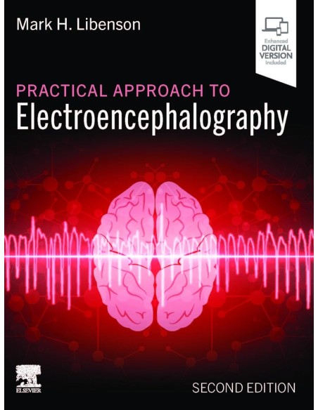 Practical approach to electroencephalographt