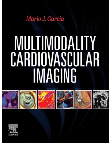 Multimodality cardiovascular imaging