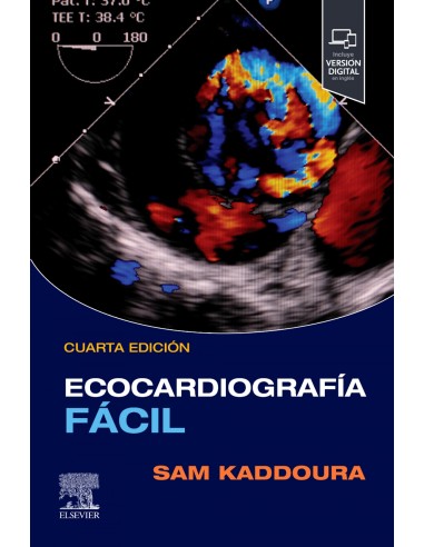 Ecocardiografia facil student consult