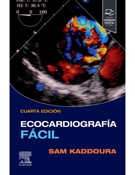 Ecocardiografia facil student consult