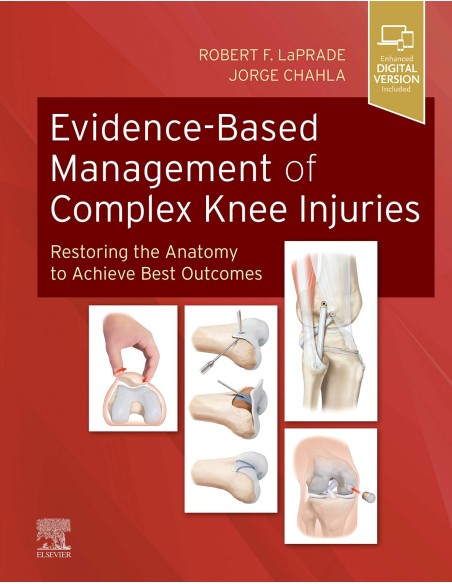 Evidence based management of complex knee injuries