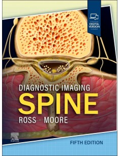 DIAGNOSTIC IMAGING SPINE