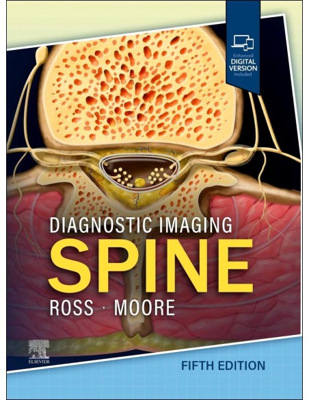 DIAGNOSTIC IMAGING SPINE