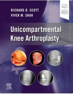 UNICOMPARTMENTAL KNEE ARTHROPLASTY
