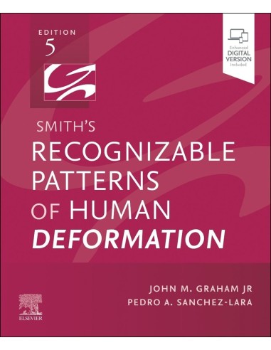 Smiths recognizable patterns of human deformation
