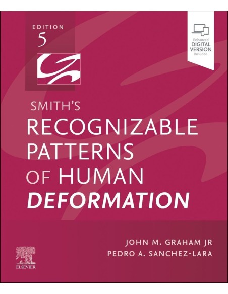 Smiths recognizable patterns of human deformation