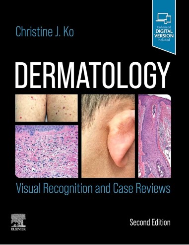 Dermatology visual recognition and case reviews