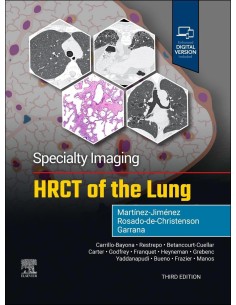 Specialty imaging hrct of the lung