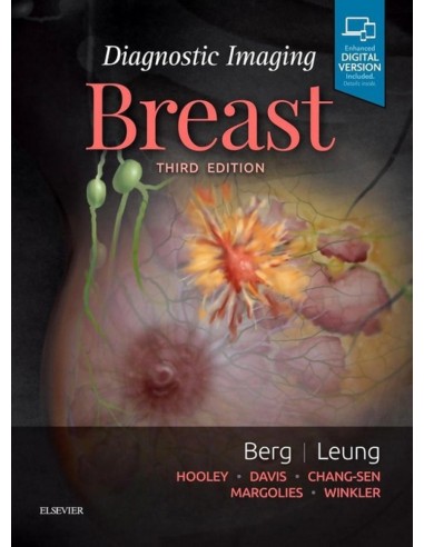 Diagnostic Imaging Breast
