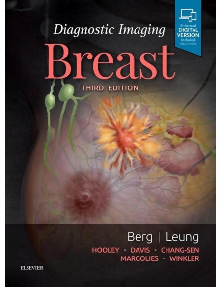 Diagnostic Imaging Breast