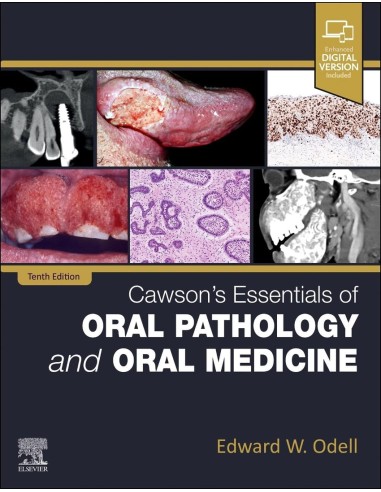 Cawsons essentials of oral pathology and oral medicine