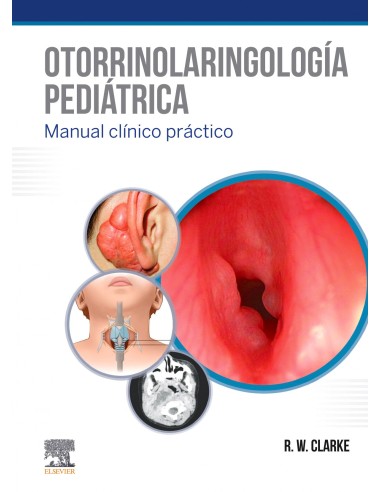 OTORRINOLARINGOLOGIA PEDIATRICA