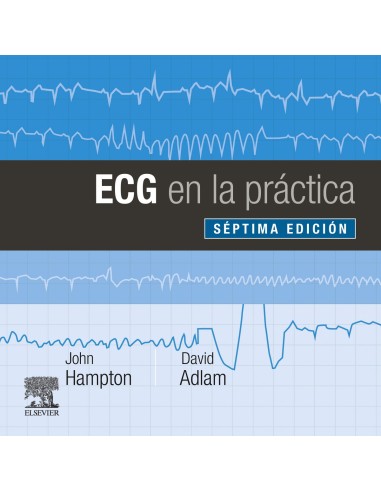 ECG EN LA PRACTICA
