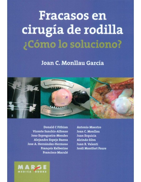 Fracasos en cirugia de rodillacomo lo soluciono