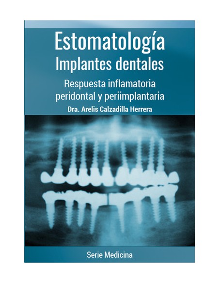 ESTOMATOLOGIA IMPLANTES DENTALES