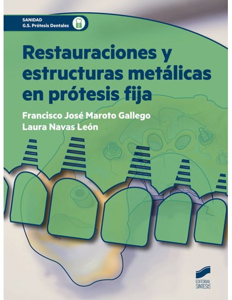 RESTAURACIONES Y ESTRUCTURAS METALICAS EN PROTESIS FIJA
