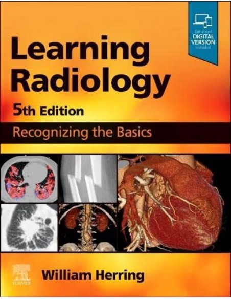 LEARNING RADIOLOGY