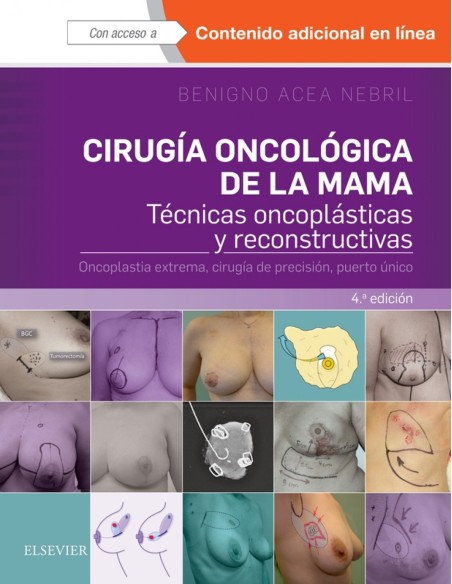CIRUGIA ONCOLOGICA DE LA MAMA