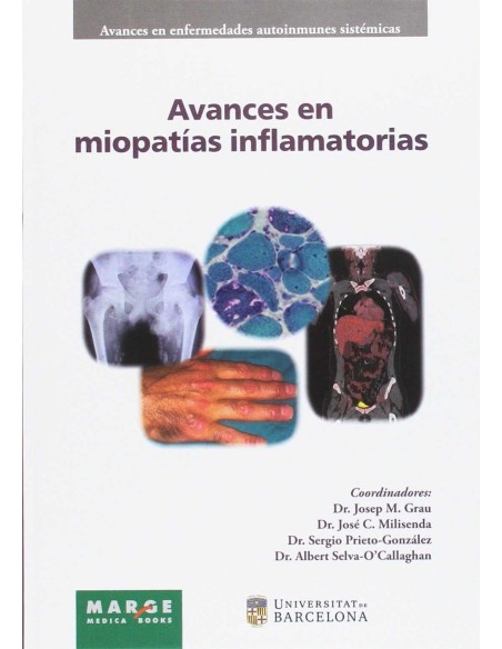 AVANCES EN MIOPATIAS INFLAMATORIAS