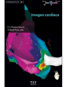 IMAGEN CARDIACA