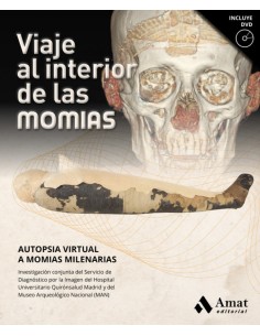 VIAJE AL INTERIOR DE LAS MOMIAS