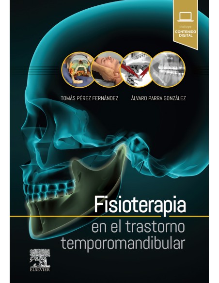 FISIOTERAPIA EN EL TRASTORNO TEMPOROMANDIBULAR