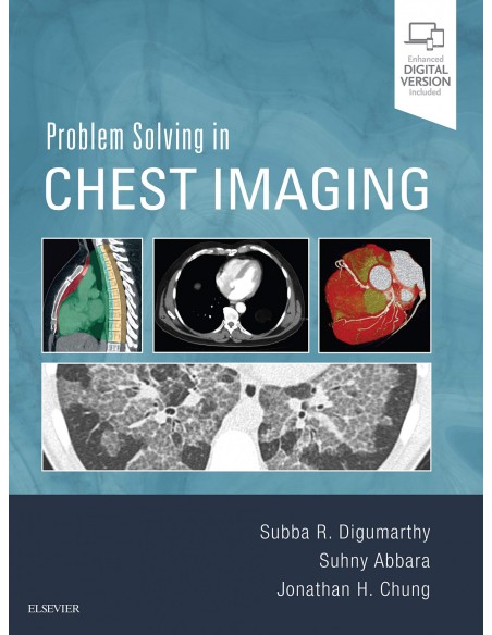 PROBLEM SOLVING IN CHEST IMAGING