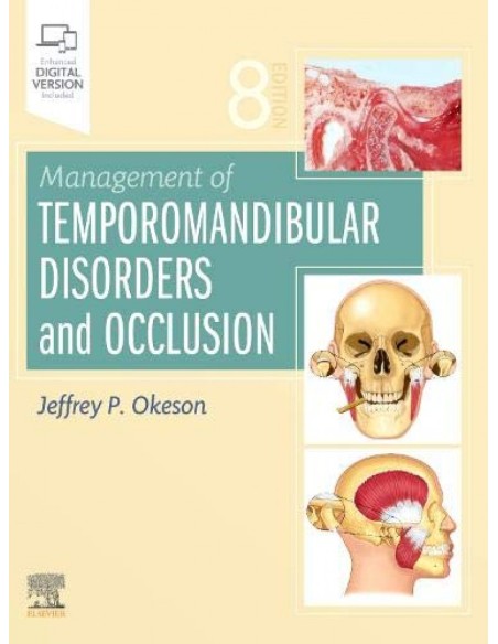 MANAGEMENT OF TEMPOROMANDIBULAR DISORDERS AND OCCLUSION