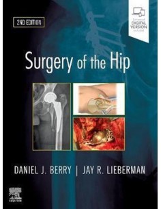 SURGERY OF THE HIP