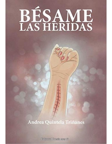 BESAME LAS HERIDAS