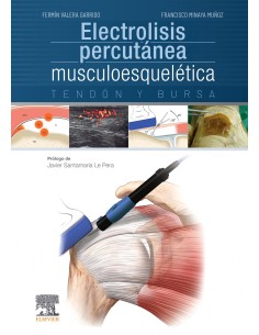 Electrolisis percutanea musculoesqueletica Tendon y bursa