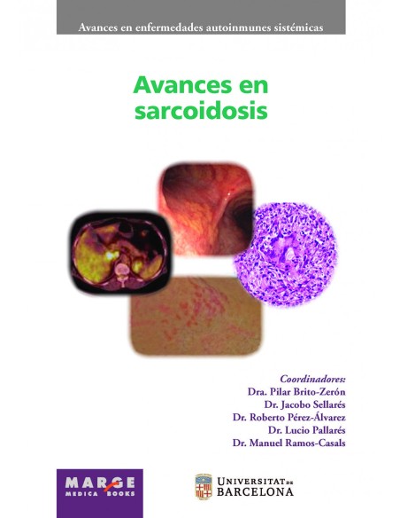 Avances en sarcoidosis