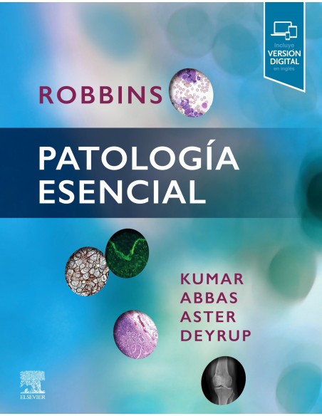 Kumar Robbins patologia esencial