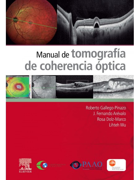 Manual de tomografia de coherencia optica