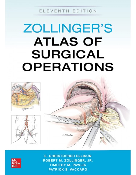ZOLLINGER S ATLAS OF SURGICAL OPERATIONS