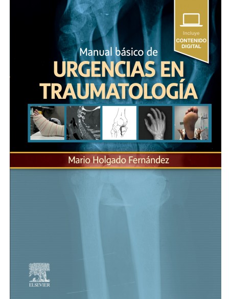 Manual basico de urgencias en traumatologia