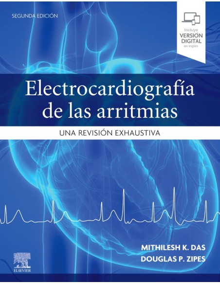 Electrocardiografia de las arritmias