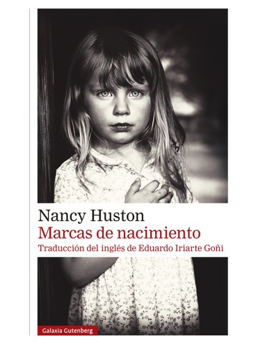 Marcas de nacimiento