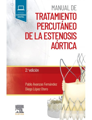 Manual de tratamiento percutaneo de la estenosis aortica