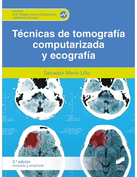 TECNICA DE TOMOGRAFIA COMPUTARIZADA Y ECOGRAFIA 3A EDICION REVISADA