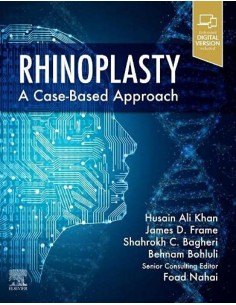 RHINOPLASTY