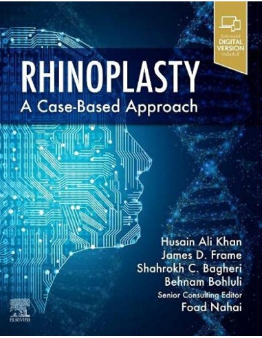 RHINOPLASTY